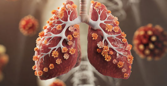 6 Groups at High-Risk for Lung Cancer